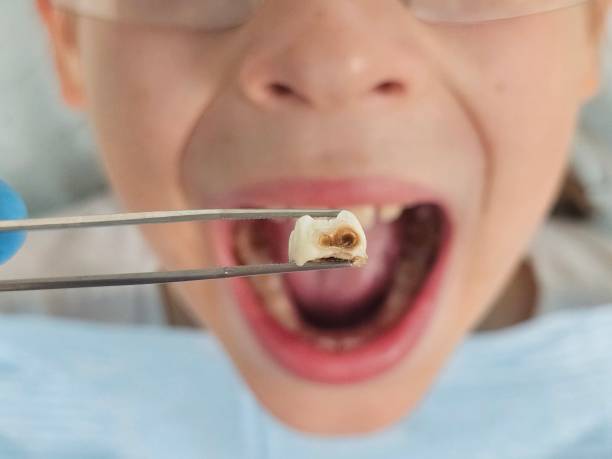 Best 24-Hour Emergency Dental Care in Granite, OK